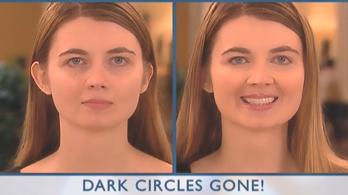 Split screen before and after with the Dark Circles Gone title